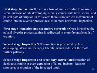 impacted canine tooth: Clinical Features, Radiographic Evaluation, and ...