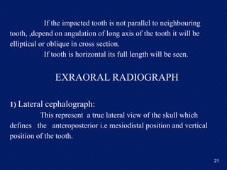 impacted canine tooth: Clinical Features, Radiographic Evaluation, and ...