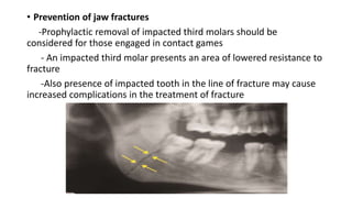 • Prevention of jaw fractures
-Prophylactic removal of impacted third molars should be
considered for those engaged in contact games
- An impacted third molar presents an area of lowered resistance to
fracture
-Also presence of impacted tooth in the line of fracture may cause
increased complications in the treatment of fracture
 