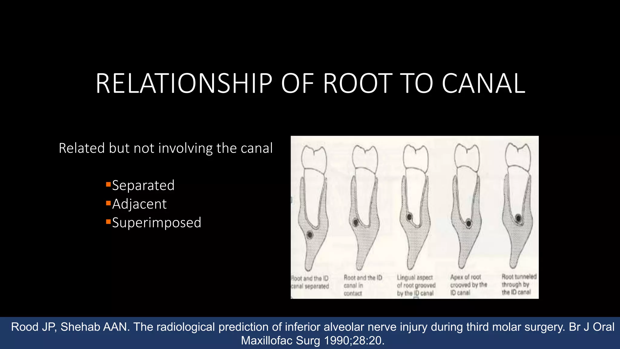 Impacted mandibular third molars | PPTX