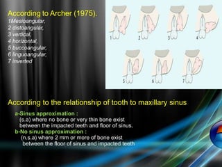 According to Archer (1975).
1Mesioangular,
2 distoangular,
3 vertical,
4 horizontal,
5 buccoangular,
6 linguoangular,
7 inverted
According to the relationship of tooth to maxillary sinus
a-Sinus approximation :
(s.a) where no bone or very thin bone exist
between the impacted teeth and floor of sinus.
b-No sinus approximation :
(n.s.a) where 2 mm or more of bone exist
between the floor of sinus and impacted teeth
 