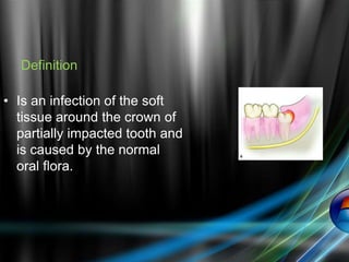 Definition
• Is an infection of the soft
tissue around the crown of
partially impacted tooth and
is caused by the normal
oral flora.
 