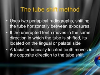 The tube shift method
• Uses two periapical radiographs, shifting
the tube horizontally between exposures.
• If the unerupted teeth moves in the same
direction in which the tube is shifted, its
located on the lingual or palatal side
• A facial or buccally located tooth moves in
the opposite direction to the tube shift.
 