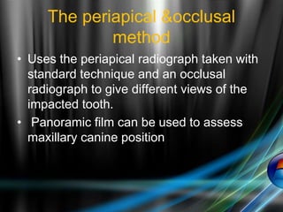 The periapical &occlusal
method
• Uses the periapical radiograph taken with
standard technique and an occlusal
radiograph to give different views of the
impacted tooth.
• Panoramic film can be used to assess
maxillary canine position
 