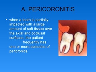A. PERICORONITIS
• when a tooth is partially
impacted with a large
amount of soft tissue over
the axial and occlusal
surfaces, the patient
frequently has
one or more episodes of
pericronitis.
 