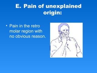 E. Pain of unexplained
origin:
• Pain in the retro
molar region with
no obvious reason.
 
