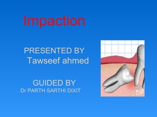 Impaction
PRESENTED BY
Tawseef ahmed
GUIDED BY
Dr PARTH SARTHI DIXIT
 