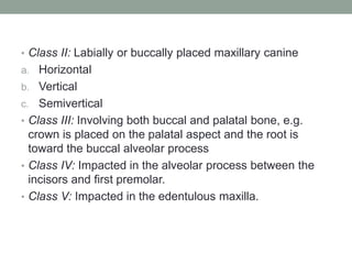 • Class II: Labially or buccally placed maxillary canine
a. Horizontal
b. Vertical
c. Semivertical
• Class III: Involving both buccal and palatal bone, e.g.
crown is placed on the palatal aspect and the root is
toward the buccal alveolar process
• Class IV: Impacted in the alveolar process between the
incisors and first premolar.
• Class V: Impacted in the edentulous maxilla.
 