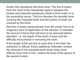 • Amber line represents the bone level. The line is drawn
from the crest of the interdental septum between the
molars and extended posteriorly distal to third molar or to
the ascending ramus. This line denotes the alveolar bone
covering the impacted tooth and the portion of tooth not
covered by the bone.
• Red line is drawn perpendicular from the amber line to an
imaginary point of application of the elevator. It indicates
the amount of bone that will have to be removed before
elevation, i.e. the depth of the tooth in bone and the
difficulty encountered in removing the tooth.
If the length of the red line is more than 5 mm then the
extraction is difficult. Every additional millimeter renders
the removal of the impacted tooth three times more
difficult (more than 9 mm—below the level of the apices of
the second molar).
 