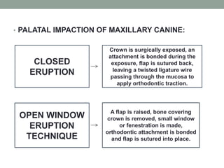 • PALATAL IMPACTION OF MAXILLARY CANINE:
CLOSED
ERUPTION
Crown is surgically exposed, an
attachment is bonded during the
exposure, flap is sutured back,
leaving a twisted ligature wire
passing through the mucosa to
apply orthodontic traction.
OPEN WINDOW
ERUPTION
TECHNIQUE
A flap is raised, bone covering
crown is removed, small window
or fenestration is made,
orthodontic attachment is bonded
and flap is sutured into place.
 