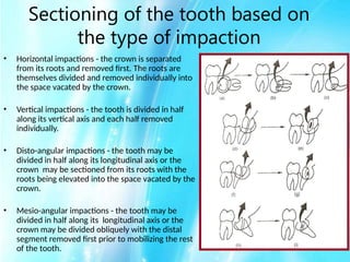 IMPACTED_TEETH[1] FDFG - Read-Only.pptx