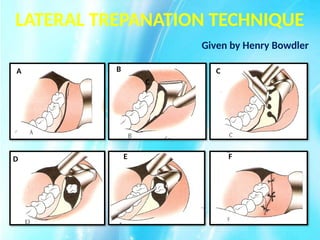 IMPACTED_TEETH[1] FDFG - Read-Only.pptx