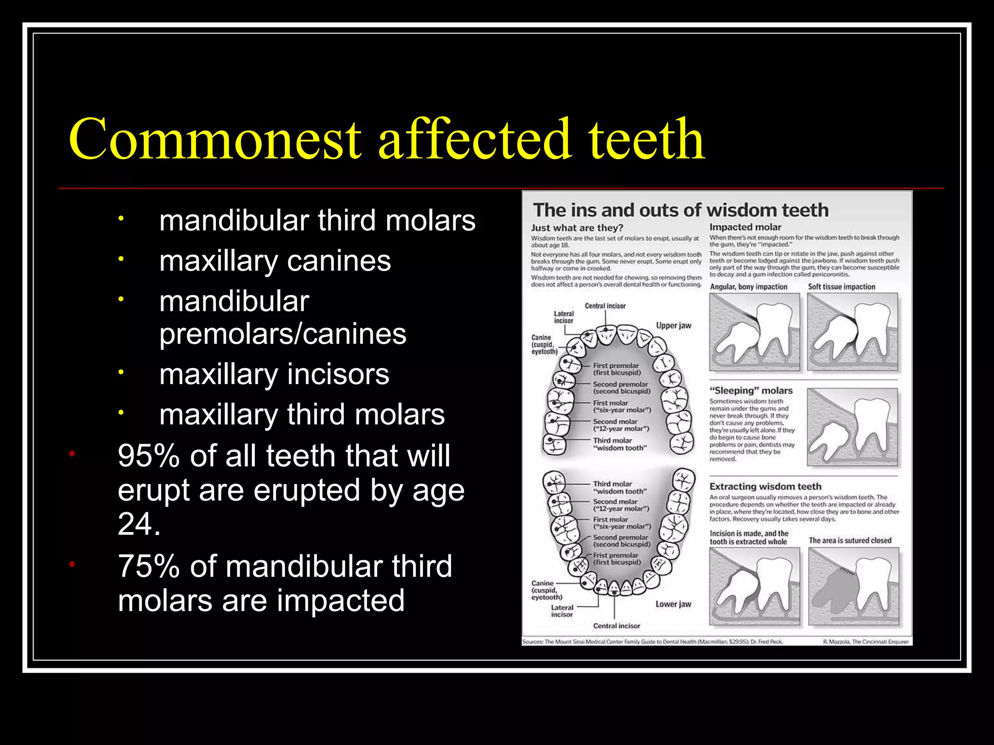 Impacted teeth | PPT