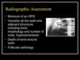 Impacted teeth Slide 13