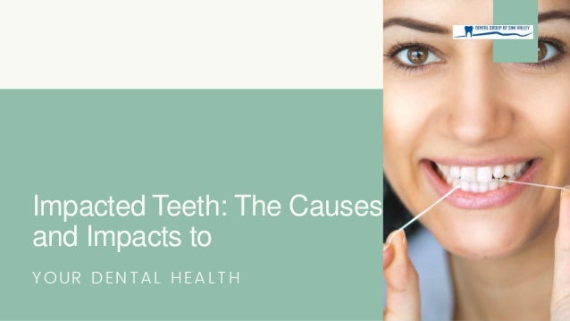 Impacted Teeth: The Causes
and Impacts to
YOUR DENTAL HEALTH
 