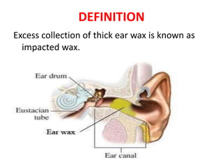 DEFINITION
Excess collection of thick ear wax is known as
impacted wax.