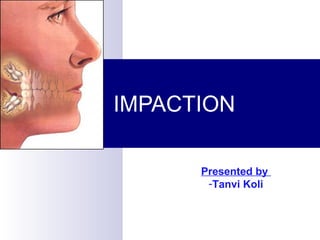 IMPACTION
Presented by
-Tanvi Koli
 