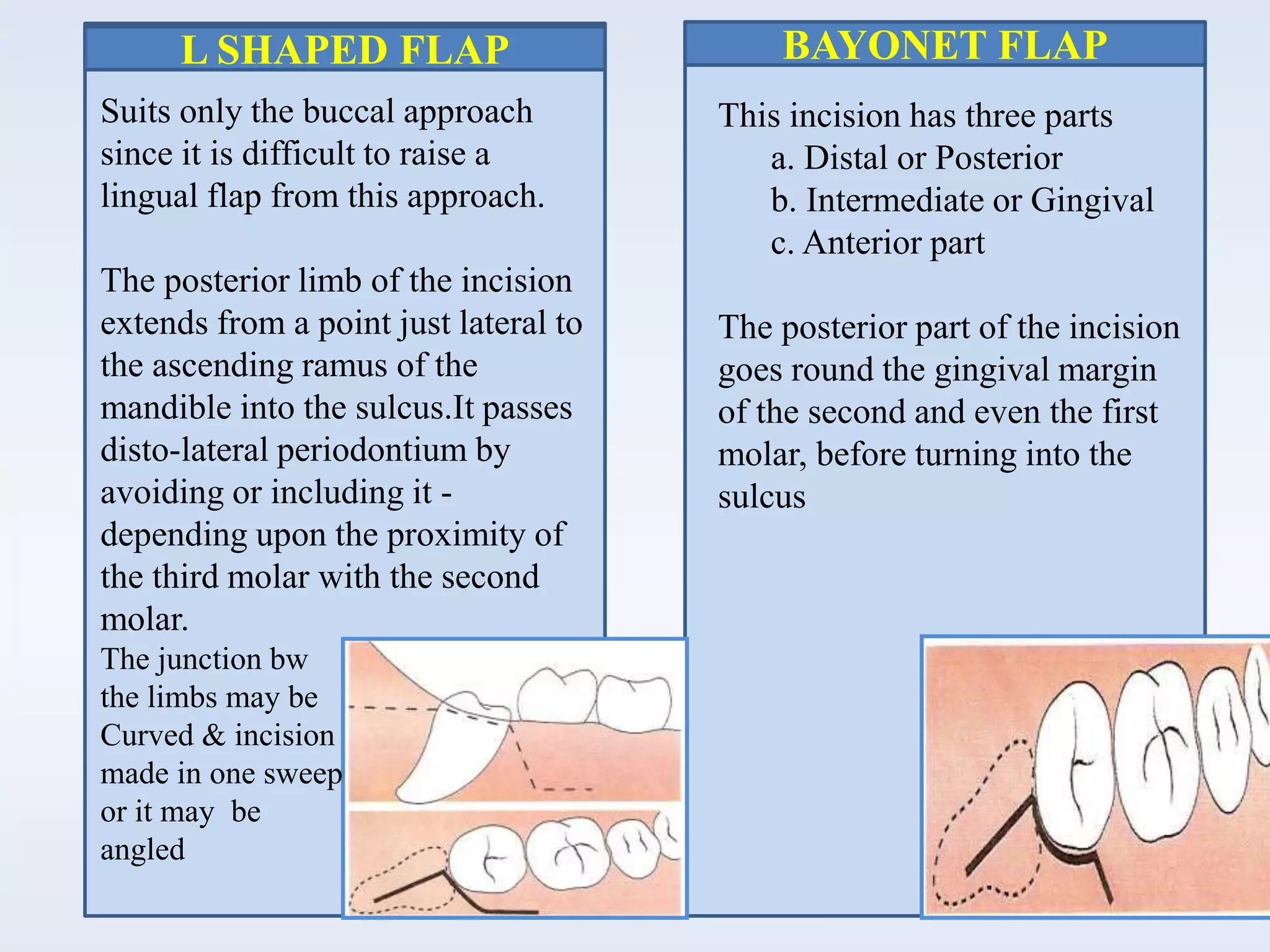 BAYONET FLAPL SHAPED FLAP
Suits only the buccal approach
since it is difficult to raise a
lingual flap from this approach.
The posterior limb of the incision
extends from a point just lateral to
the ascending ramus of the
mandible into the sulcus.It passes
disto-lateral periodontium by
avoiding or including it -
depending upon the proximity of
the third molar with the second
molar.
The junction bw
the limbs may be
Curved & incision
made in one sweep
or it may be
angled
This incision has three parts
a. Distal or Posterior
b. Intermediate or Gingival
c. Anterior part
The posterior part of the incision
goes round the gingival margin
of the second and even the first
molar, before turning into the
sulcus
 