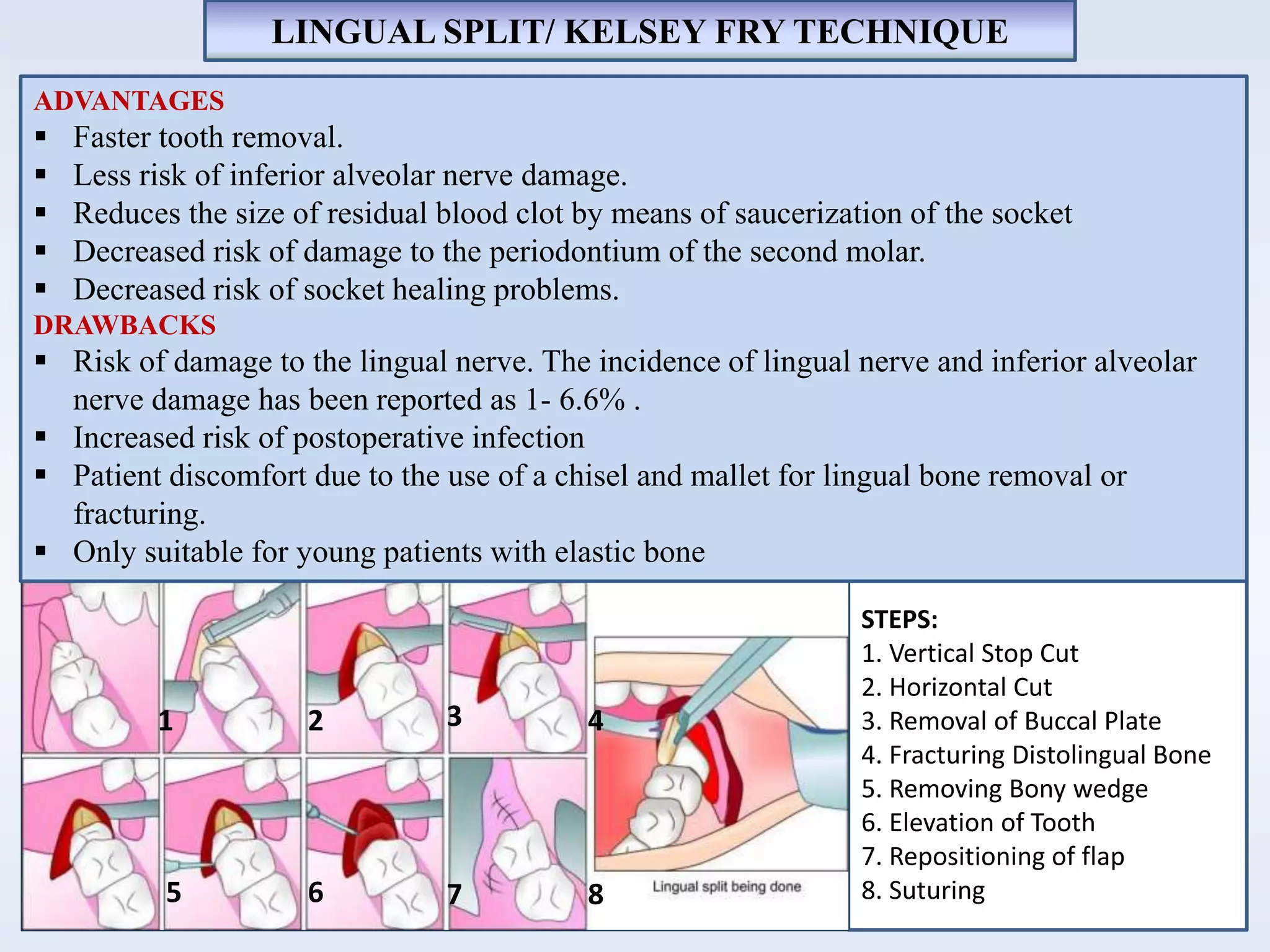 1 32 4
5 6 7 8
STEPS:
1. Vertical Stop Cut
2. Horizontal Cut
3. Removal of Buccal Plate
4. Fracturing Distolingual Bone
5. Removing Bony wedge
6. Elevation of Tooth
7. Repositioning of flap
8. Suturing
LINGUAL SPLIT/ KELSEY FRY TECHNIQUE
ADVANTAGES
 Faster tooth removal.
 Less risk of inferior alveolar nerve damage.
 Reduces the size of residual blood clot by means of saucerization of the socket
 Decreased risk of damage to the periodontium of the second molar.
 Decreased risk of socket healing problems.
DRAWBACKS
 Risk of damage to the lingual nerve. The incidence of lingual nerve and inferior alveolar
nerve damage has been reported as 1- 6.6% .
 Increased risk of postoperative infection
 Patient discomfort due to the use of a chisel and mallet for lingual bone removal or
fracturing.
 Only suitable for young patients with elastic bone
 