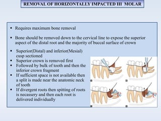 REMOVAL OF HORIZONTALLY IMPACTED III MOLAR
 Superior(Distal) and inferior(Mesial)
cusp sectioned
 Superior crown is removed first
 Followed by bulk of tooth and then the
inferior crown fragment
 If sufficient space is not available then
a split is made near the anatomic neck
of tooth
 If divergent roots then spitting of roots
is necassery and then each root is
delivered individually
 Requires maximum bone removal
 Bone should be removed down to the cervical line to expose the superior
aspect of the distal root and the majority of buccal surface of crown
 