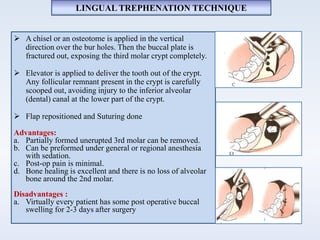 LINGUAL TREPHENATION TECHNIQUE
 A chisel or an osteotome is applied in the vertical
direction over the bur holes. Then the buccal plate is
fractured out, exposing the third molar crypt completely.
 Elevator is applied to deliver the tooth out of the crypt.
Any follicular remnant present in the crypt is carefully
scooped out, avoiding injury to the inferior alveolar
(dental) canal at the lower part of the crypt.
 Flap repositioned and Suturing done
Advantages:
a. Partially formed unerupted 3rd molar can be removed.
b. Can be preformed under general or regional anesthesia
with sedation.
c. Post-op pain is minimal.
d. Bone healing is excellent and there is no loss of alveolar
bone around the 2nd molar.
Disadvantages :
a. Virtually every patient has some post operative buccal
swelling for 2-3 days after surgery
 