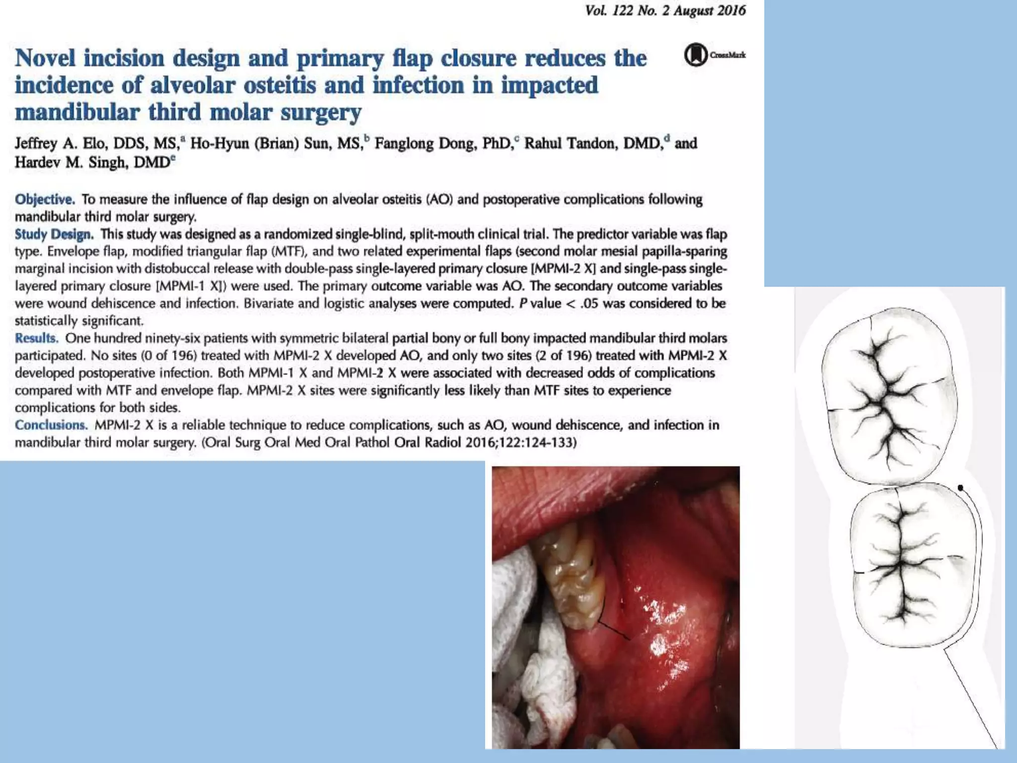 IMPACTION IN ORAL SURGERY | PPTX