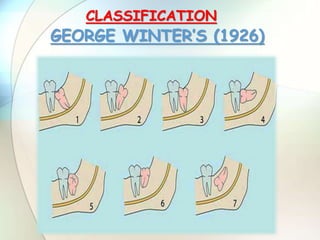 CLASSIFICATION
GEORGE WINTER’S (1926)
 