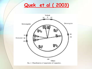 Quek et al ( 2003)
 