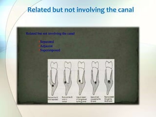 Related but not involving the canal
 