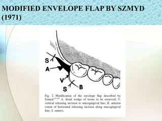 MODIFIED ENVELOPE FLAP BY SZMYD
(1971)
 