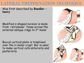 LATERAL TREPHENATION TECHNIQUE
• Was first described by Bowdler –
henry
• Modified s-shaped incision is made
from retromolar fossa across the
external oblique ridge to 1st molar
• Buccal cortical plate is trephined
over the iii molar crypt. Bur is used
to make vertical cuts anteriorly and
posteriorly.
 