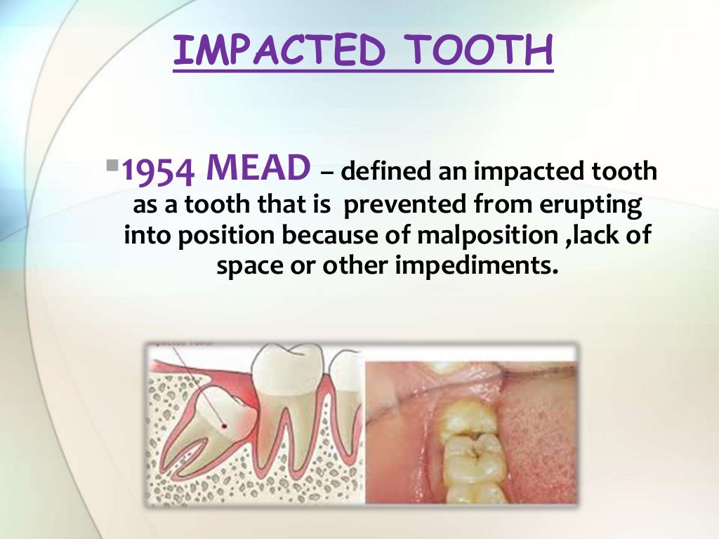 IMPACTION IN ORAL SURGERY