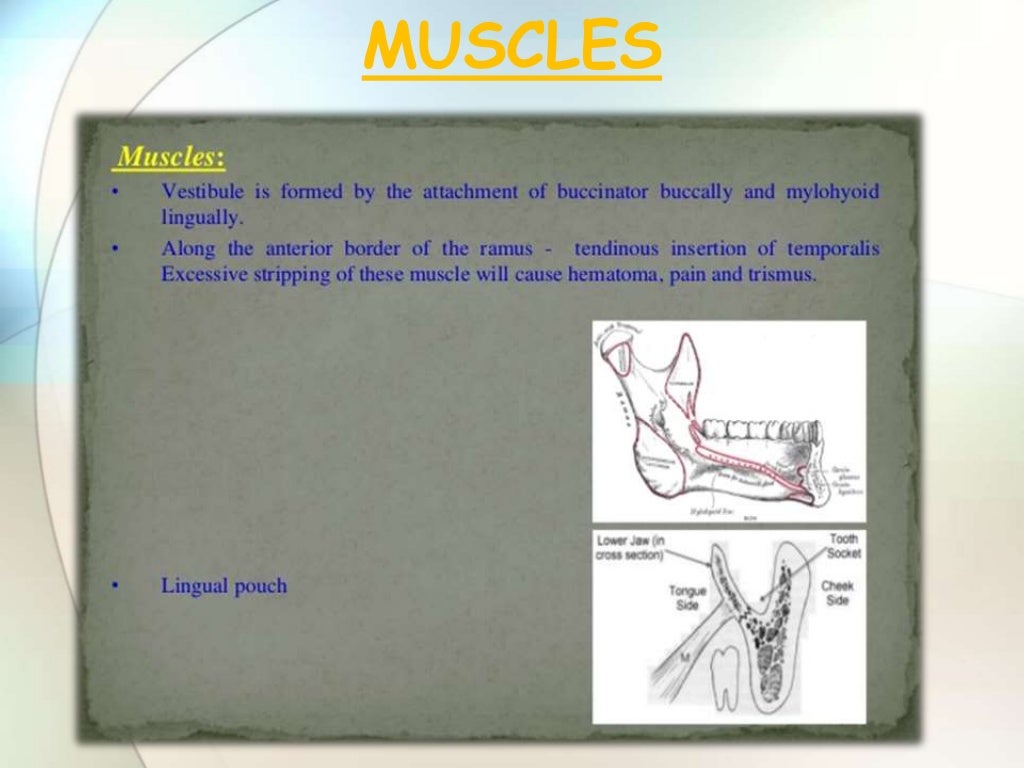 IMPACTION IN ORAL SURGERY