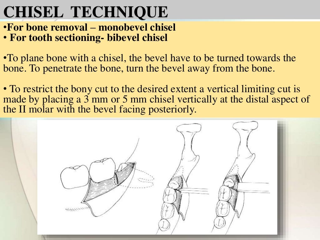 IMPACTION IN ORAL SURGERY