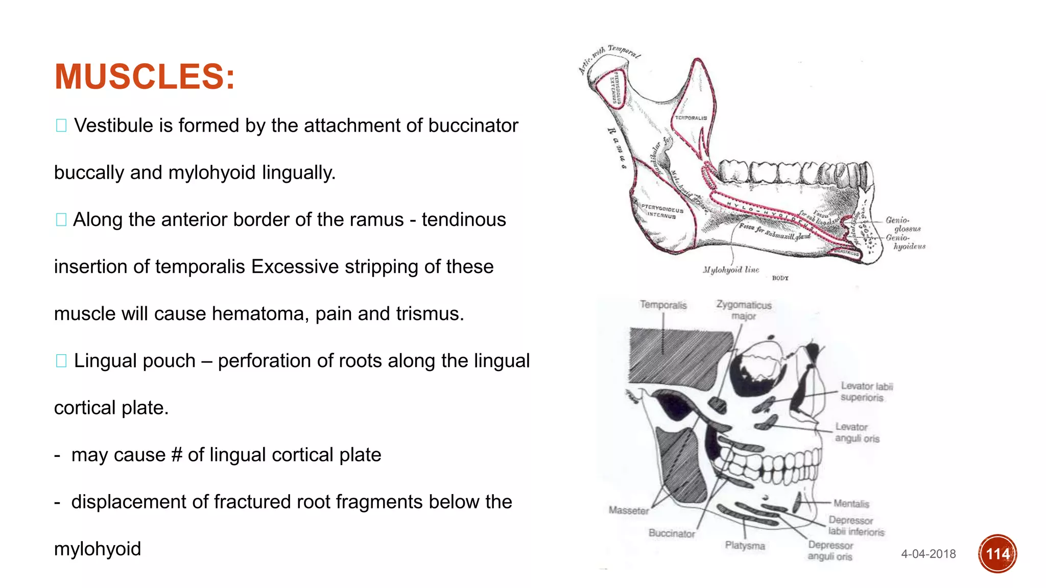14-04-2018 114
MUSCLES:
Vestibule is formed by the attachment of buccinator
buccally and mylohyoid lingually.
Along the anterior border of the ramus - tendinous
insertion of temporalis Excessive stripping of these
muscle will cause hematoma, pain and trismus.
Lingual pouch – perforation of roots along the lingual
cortical plate.
- may cause # of lingual cortical plate
- displacement of fractured root fragments below the
mylohyoid
 