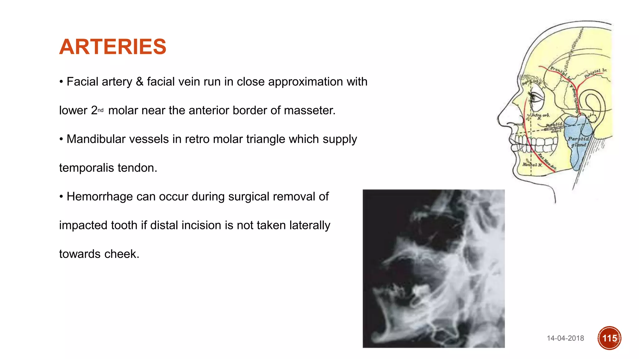 14-04-2018 115
ARTERIES
• Facial artery & facial vein run in close approximation with
lower 2nd molar near the anterior border of masseter.
• Mandibular vessels in retro molar triangle which supply
temporalis tendon.
• Hemorrhage can occur during surgical removal of
impacted tooth if distal incision is not taken laterally
towards cheek.
 