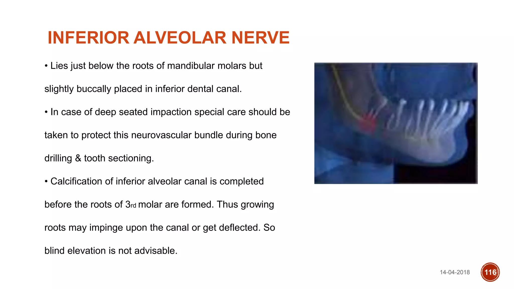 14-04-2018 116
INFERIOR ALVEOLAR NERVE
• Lies just below the roots of mandibular molars but
slightly buccally placed in inferior dental canal.
• In case of deep seated impaction special care should be
taken to protect this neurovascular bundle during bone
drilling & tooth sectioning.
• Calcification of inferior alveolar canal is completed
before the roots of 3rd molar are formed. Thus growing
roots may impinge upon the canal or get deflected. So
blind elevation is not advisable.
 