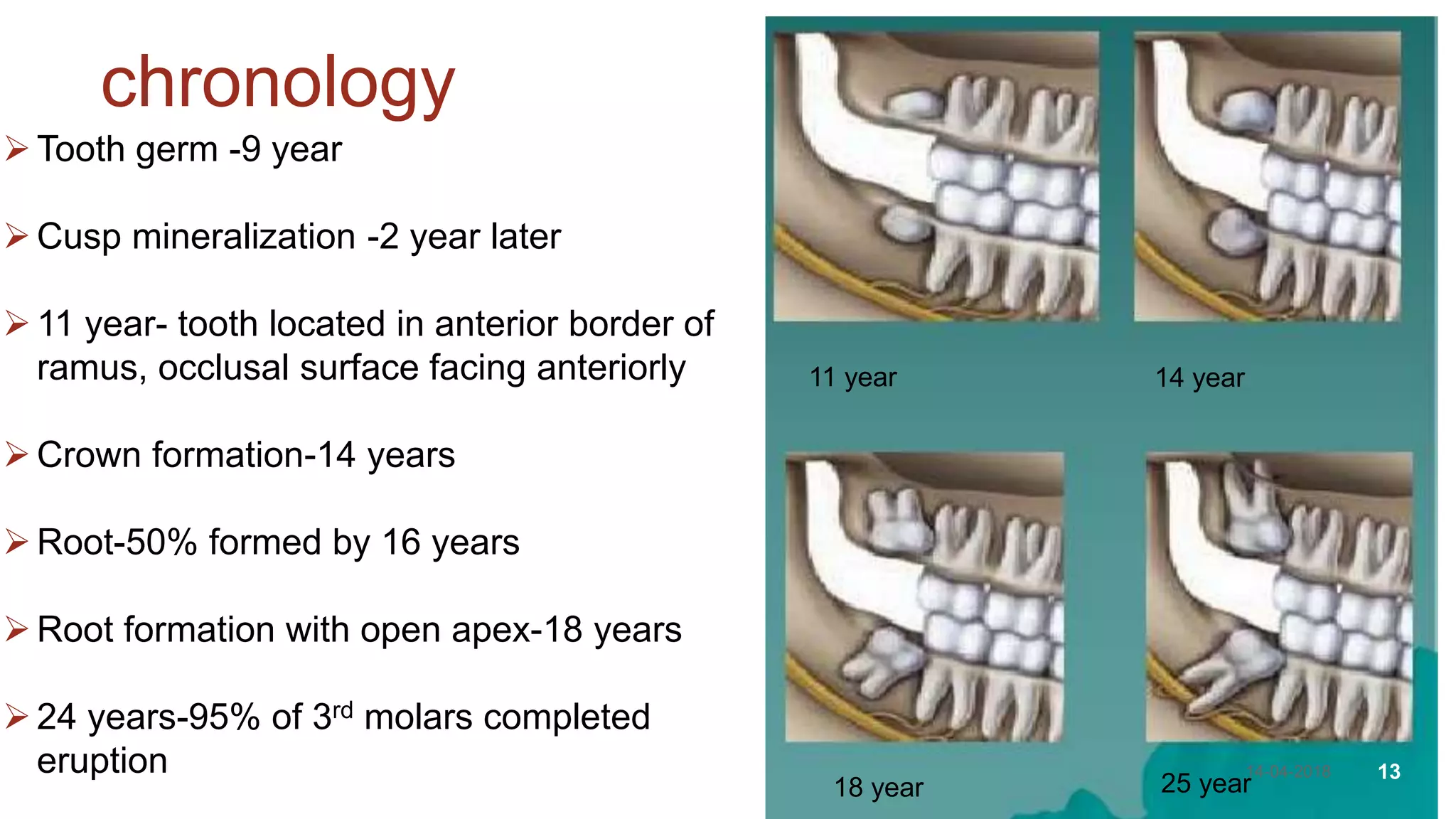 11 year 14 year
18 year 25 year
Tooth germ -9 year
Cusp mineralization -2 year later
11 year- tooth located in anterior border of
ramus, occlusal surface facing anteriorly
Crown formation-14 years
Root-50% formed by 16 years
Root formation with open apex-18 years
24 years-95% of 3rd molars completed
eruption
chronology
14-04-2018 13
 
