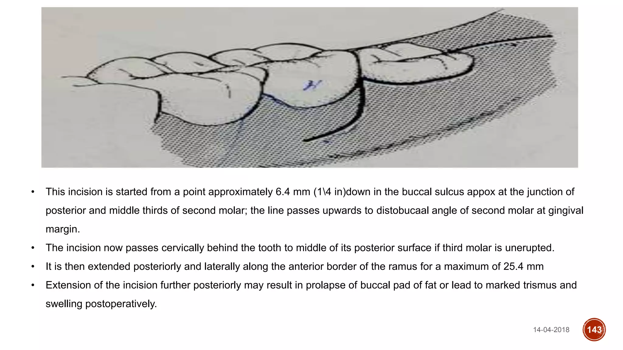 14-04-2018 143
• This incision is started from a point approximately 6.4 mm (14 in)down in the buccal sulcus appox at the junction of
posterior and middle thirds of second molar; the line passes upwards to distobucaal angle of second molar at gingival
margin.
• The incision now passes cervically behind the tooth to middle of its posterior surface if third molar is unerupted.
• It is then extended posteriorly and laterally along the anterior border of the ramus for a maximum of 25.4 mm
• Extension of the incision further posteriorly may result in prolapse of buccal pad of fat or lead to marked trismus and
swelling postoperatively.
 