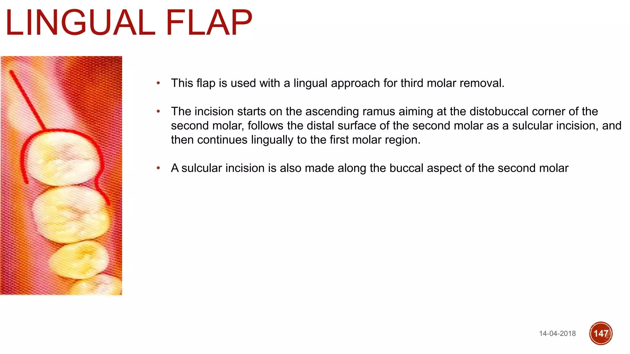 LINGUAL FLAP
• This flap is used with a lingual approach for third molar removal.
• The incision starts on the ascending ramus aiming at the distobuccal corner of the
second molar, follows the distal surface of the second molar as a sulcular incision, and
then continues lingually to the first molar region.
• A sulcular incision is also made along the buccal aspect of the second molar
14-04-2018 147
 
