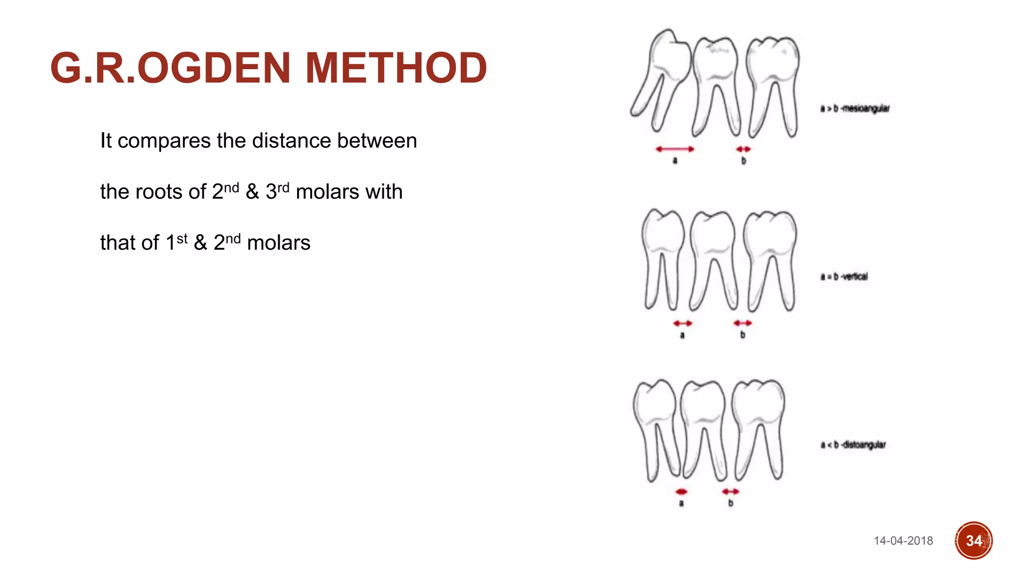 14-04-2018 34
G.R.OGDEN METHOD
It compares the distance between
the roots of 2nd & 3rd molars with
that of 1st & 2nd molars
 