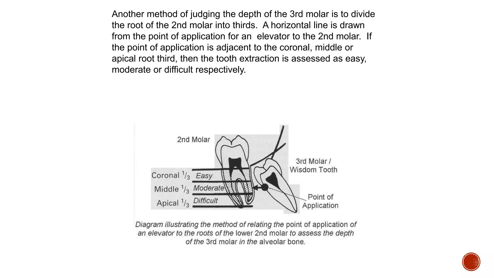Another method of judging the depth of the 3rd molar is to divide
the root of the 2nd molar into thirds. A horizontal line is drawn
from the point of application for an elevator to the 2nd molar. If
the point of application is adjacent to the coronal, middle or
apical root third, then the tooth extraction is assessed as easy,
moderate or difficult respectively.
 
