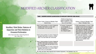 Impaction maxillary teeth part 1 | PPTX