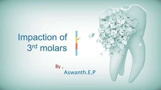 Impaction of
3rd molars
By ,
Aswanth.E.P
 
