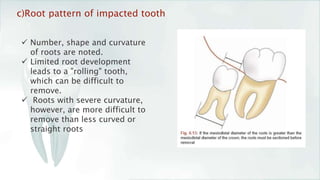 Curled Roots Teeth Impaction of mandibular 3rd molar | PPTX