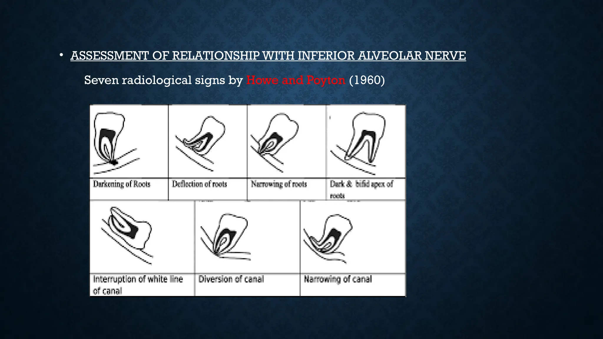 • ASSESSMENT OF RELATIONSHIP WITH INFERIOR ALVEOLAR NERVE
Seven radiological signs by Howe and Poyton (1960)
 