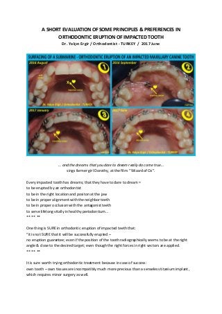A SHORT EVALUATION OF SOME PRINCIPLES & PREFERENCES IN
ORTHODONTIC ERUPTION OF IMPACTED TOOTH
Dr. Yalçın Ergir / Orthodontist - TURKEY / 2017 June
… and the dreams that you dare to dream really do come true…
sings farmer girl Dorothy, at the film: “Wizard of Oz”.
Every impacted tooth has dreams; that they have to dare to dream =
to be erupted by an orthodontist
to be in the right location and positon at the jaw
to be in proper alignment with the neighbor teeth
to be in proper occlusion with the antagonist teeth
to serve lifelong vitally in healthy periodontium…
** ** **
One thing is SURE in orthodontic eruption of impacted teeth that:
“it is not SURE that it will be successfully erupted –
no eruption guarantee; even if the position of the tooth radiographically seems to be at the right
angle & close to the desired target; even though the right forces in right vectors are applied.
** ** **
It is sure worth trying orthodontic treatment because in case of success:
own tooth – own tissues are incompatibly much more precious than a senseless titanium implant,
which requires minor surgery as well.
 
