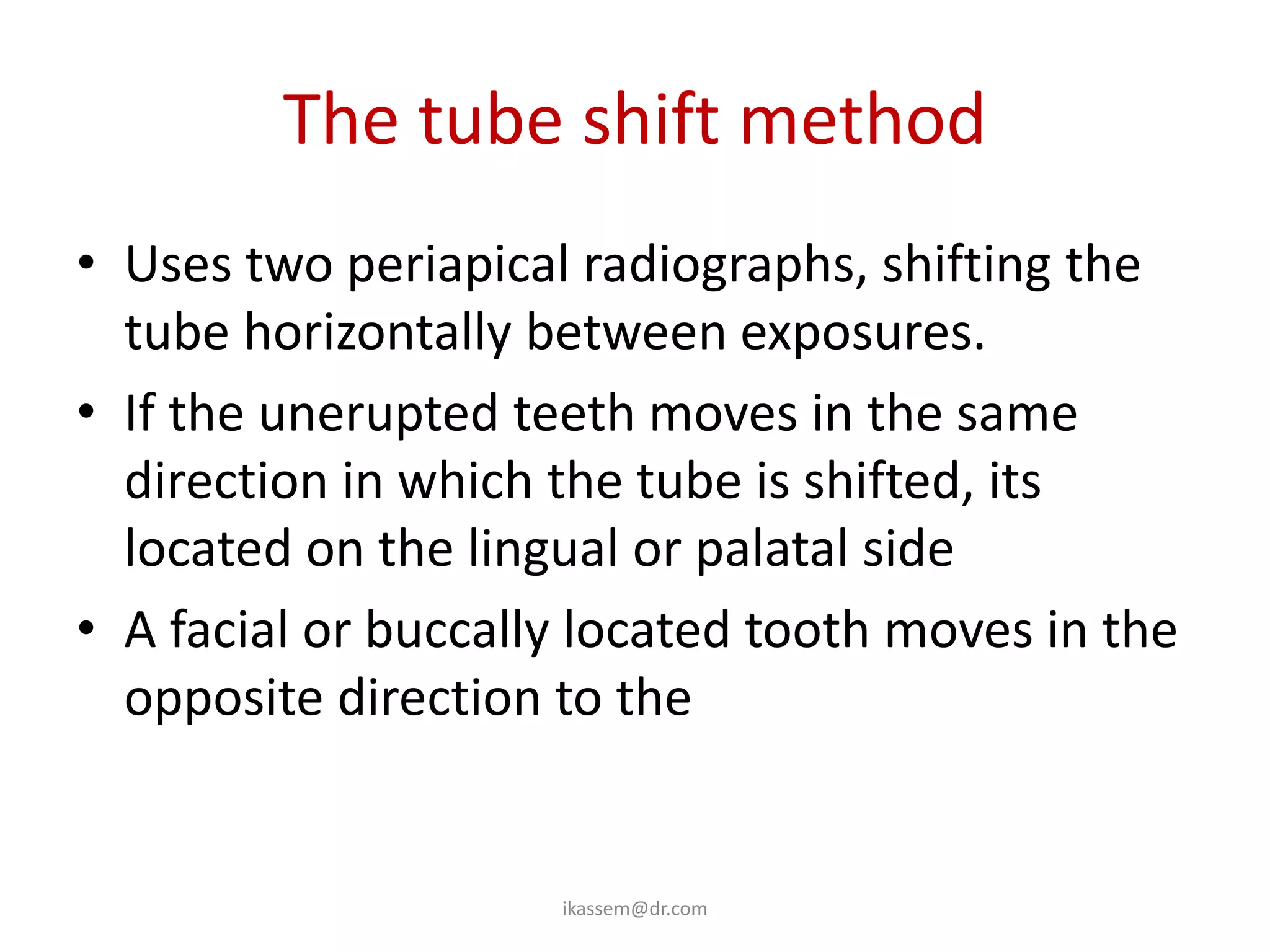 The tube shift method
• Uses two periapical radiographs, shifting the
  tube horizontally between exposures.
• If the unerupted teeth moves in the same
  direction in which the tube is shifted, its
  located on the lingual or palatal side
• A facial or buccally located tooth moves in the
  opposite direction to the tube shift.


                     ikassem@dr.com
 