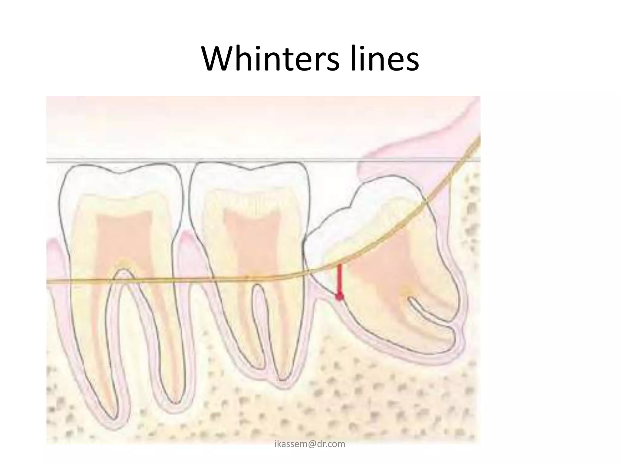 Whinters lines




    ikassem@dr.com
 