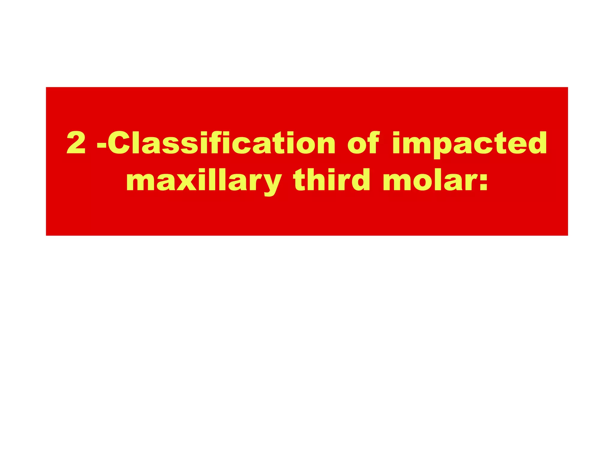 2 -Classification of impacted
    maxillary third molar:
 